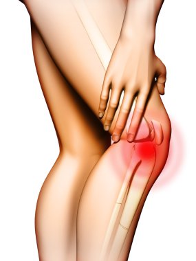 Knee pain clipart