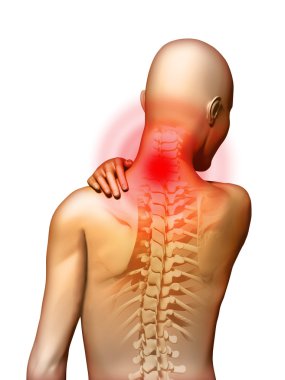 Neck pain clipart