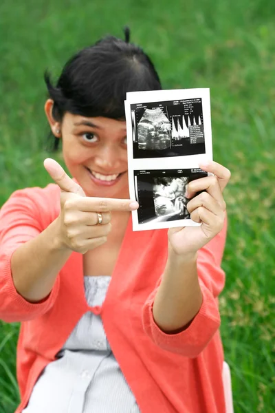 Asiática embarazada mujer apuntando ultrasonido scan resultado —  Fotos de Stock