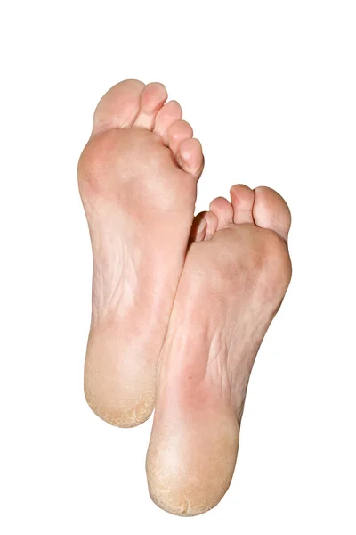 Os pés grandes — Fotografia de Stock