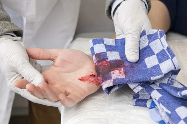Bleeding cut — Stock Photo, Image