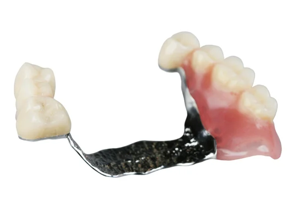 stock image Demountable denture