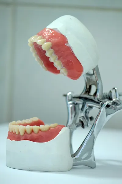 Zahnprothese — Stockfoto