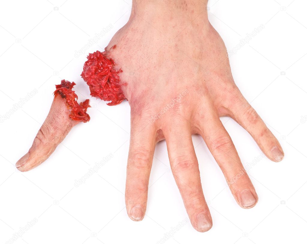 Artificial human hand with cut out finger