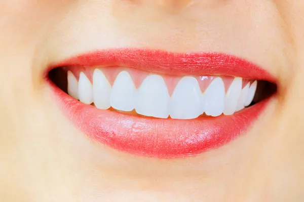Mulher sorridente com grandes dentes brancos saudáveis — Fotografia de Stock
