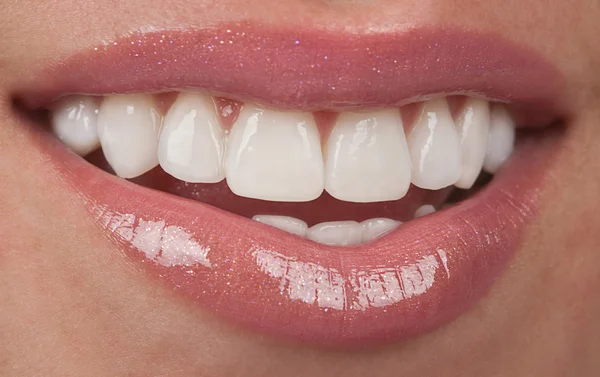 Zęby — Zdjęcie stockowe