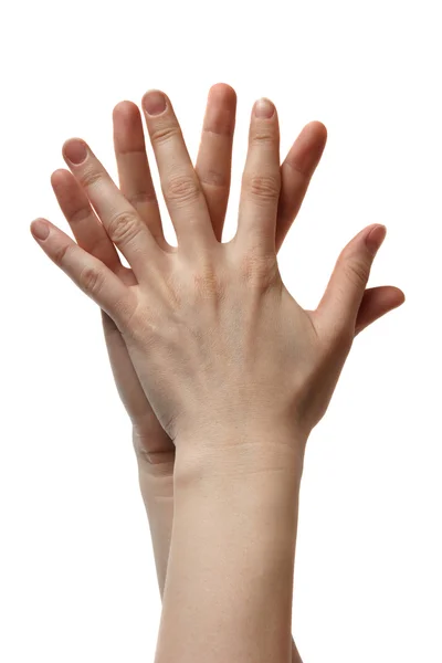 Дві руки з розбитими пальцями — стокове фото