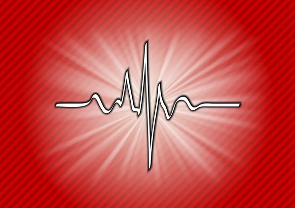 Cardiogramme — Image vectorielle