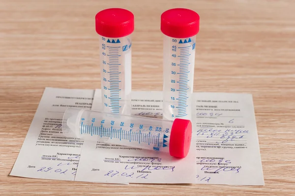 stock image Sterile containers for medical tests