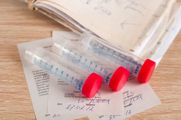 Sterila behållare för medicinska tester — Stockfoto