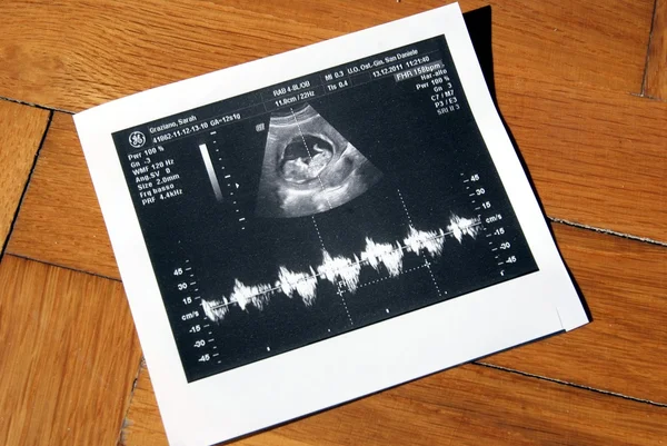 stock image Ultrasound for new life