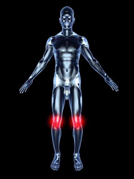 膝关节疼痛-解剖 — 图库照片