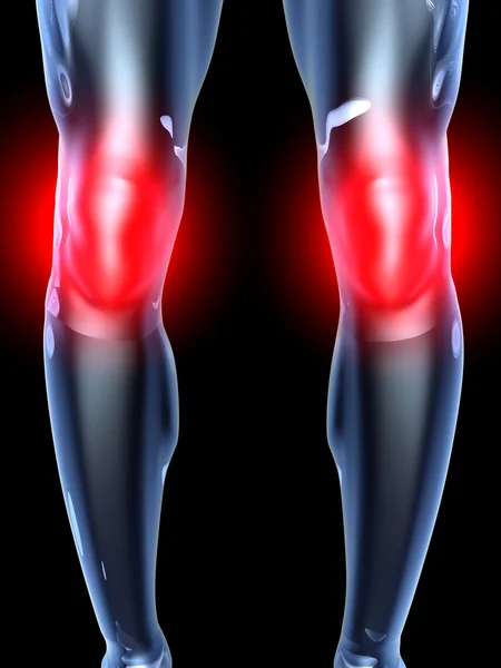 Γόνατο πόνος - ανατομία — Φωτογραφία Αρχείου