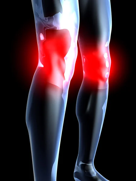Γόνατο πόνος - ανατομία — Φωτογραφία Αρχείου
