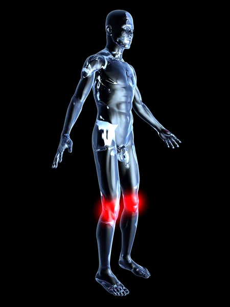 무릎 통증-해부학 — 스톡 사진