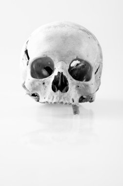 Human skull with only one tooth in black and white clipart