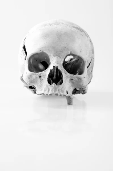 stock image Human skull with only one tooth in black and white