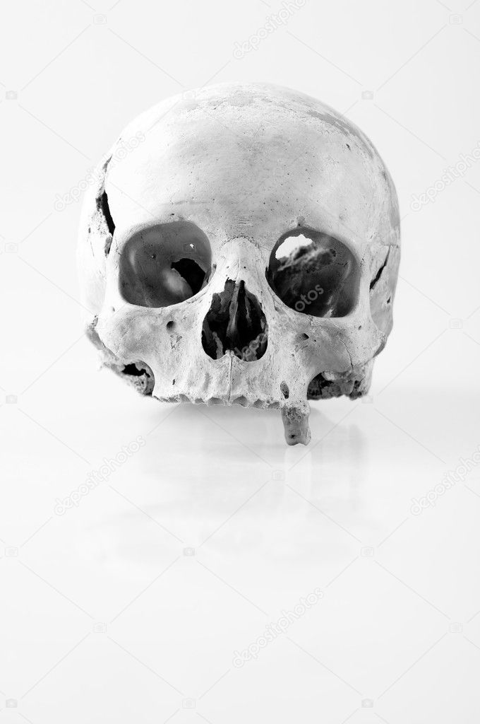 Human skull with only one tooth in black and white