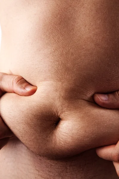 Нездоровый живот - человек с жиром на животе — стоковое фото