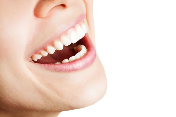 Смех счастливой женщины со здоровыми зубами — стоковое фото