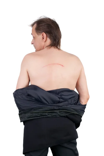 Man with the blood scratch on his back — Stock Photo, Image