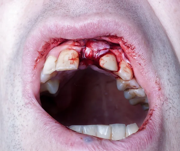 Diş Cerrahı — Stok fotoğraf
