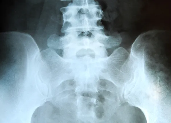 X-ray of the pelvis and spinal column. — Stock Photo, Image