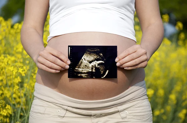 Ultrasound scan — Stock Photo, Image