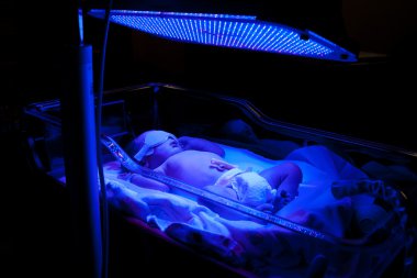 Baby with Phototherapy clipart