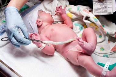 Yeni doğmuş sevimli bebek Bebek göbek kordonu ile