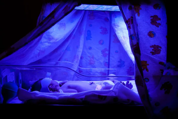 Baby under ljusbehandling — Stockfoto