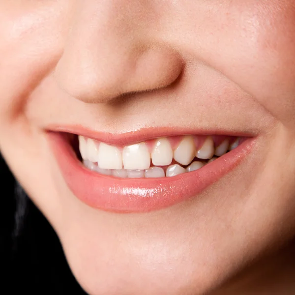 Beautiful teeth in a perfect smile — Stock Photo, Image