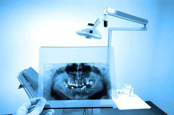 Radiografia dentale — Foto Stock