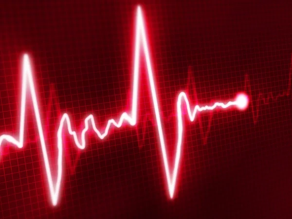 Cardiograma —  Fotos de Stock
