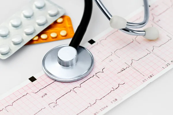 Cardiogram met stethoscoop — Stockfoto