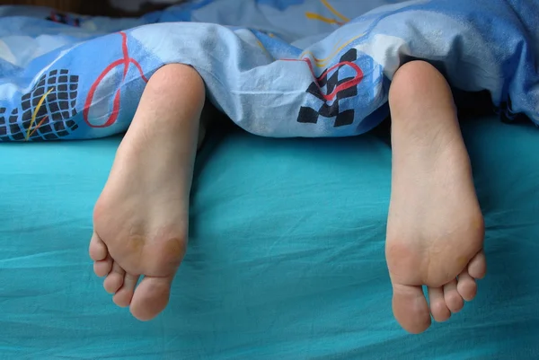 Weibliche Füße mit Schwiele — Stockfoto