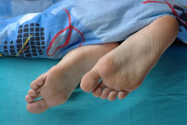 Female feet with callus — Stock Photo, Image