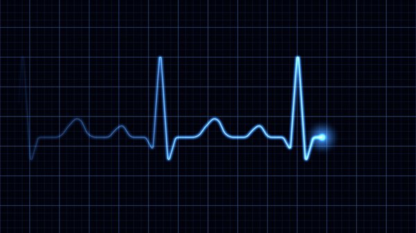 Electrocardiogram