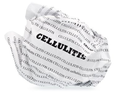 Cellulite is nervous? Throw clipart