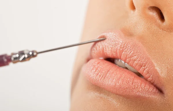 Lip enhancement behandling — Stockfoto