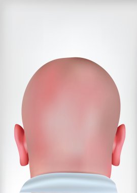 Realistic Bald Head clipart