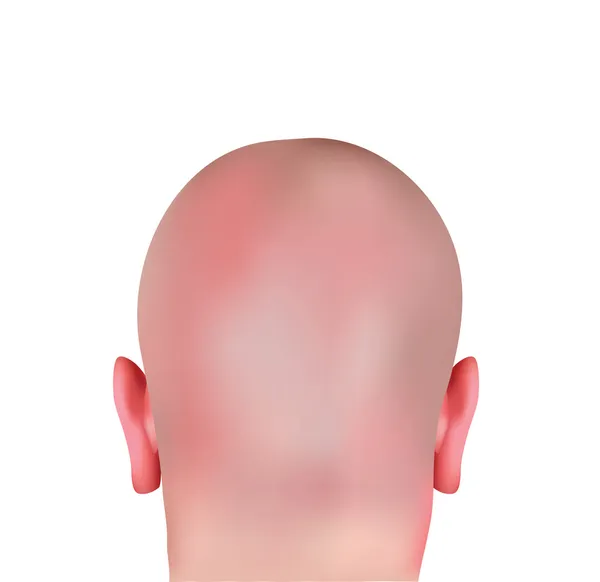 Realistic Bald Head — Stock Vector