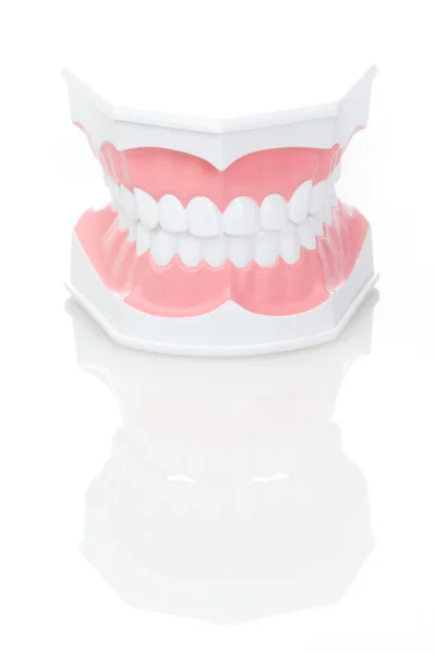 stock image Dental Model of Teeth