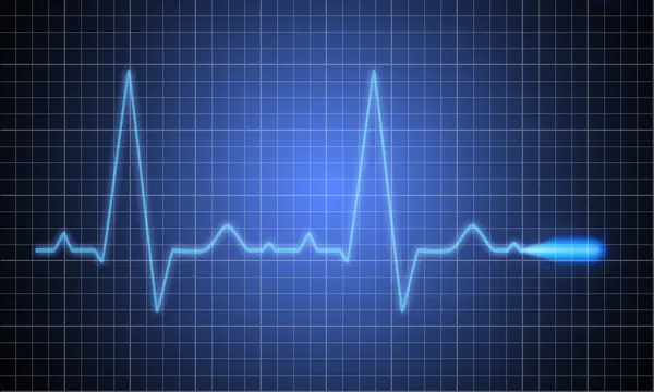 医学心脏监视器测量心电图 — 图库照片