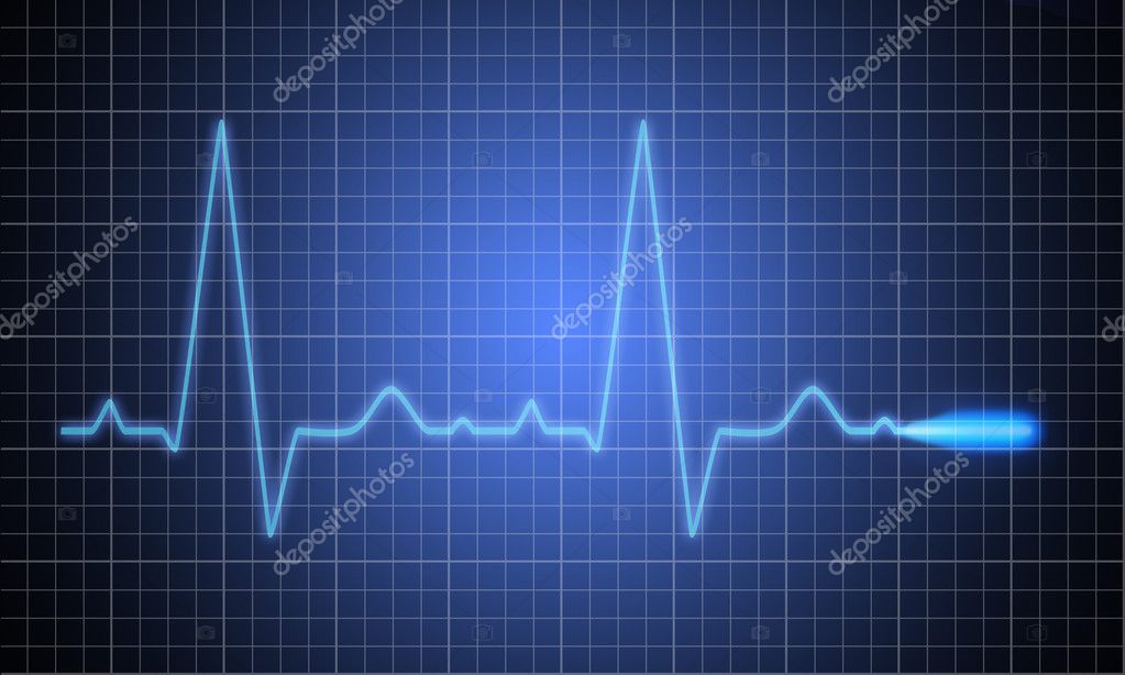 Medical heart monitor measuring ekg Stock Photo by ©arcoss 9836994