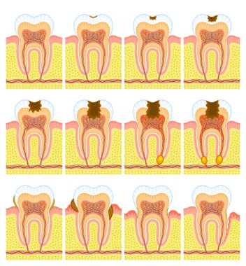 Internal structure of tooth clipart