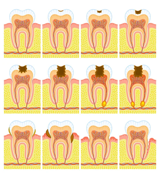 Interne structuur van tand — Stockvector