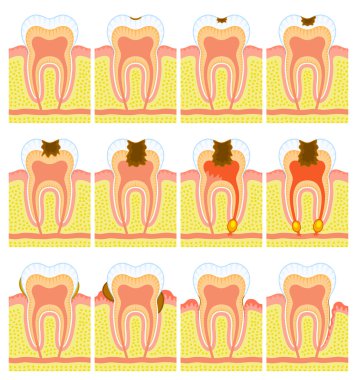 Internal structure of tooth clipart