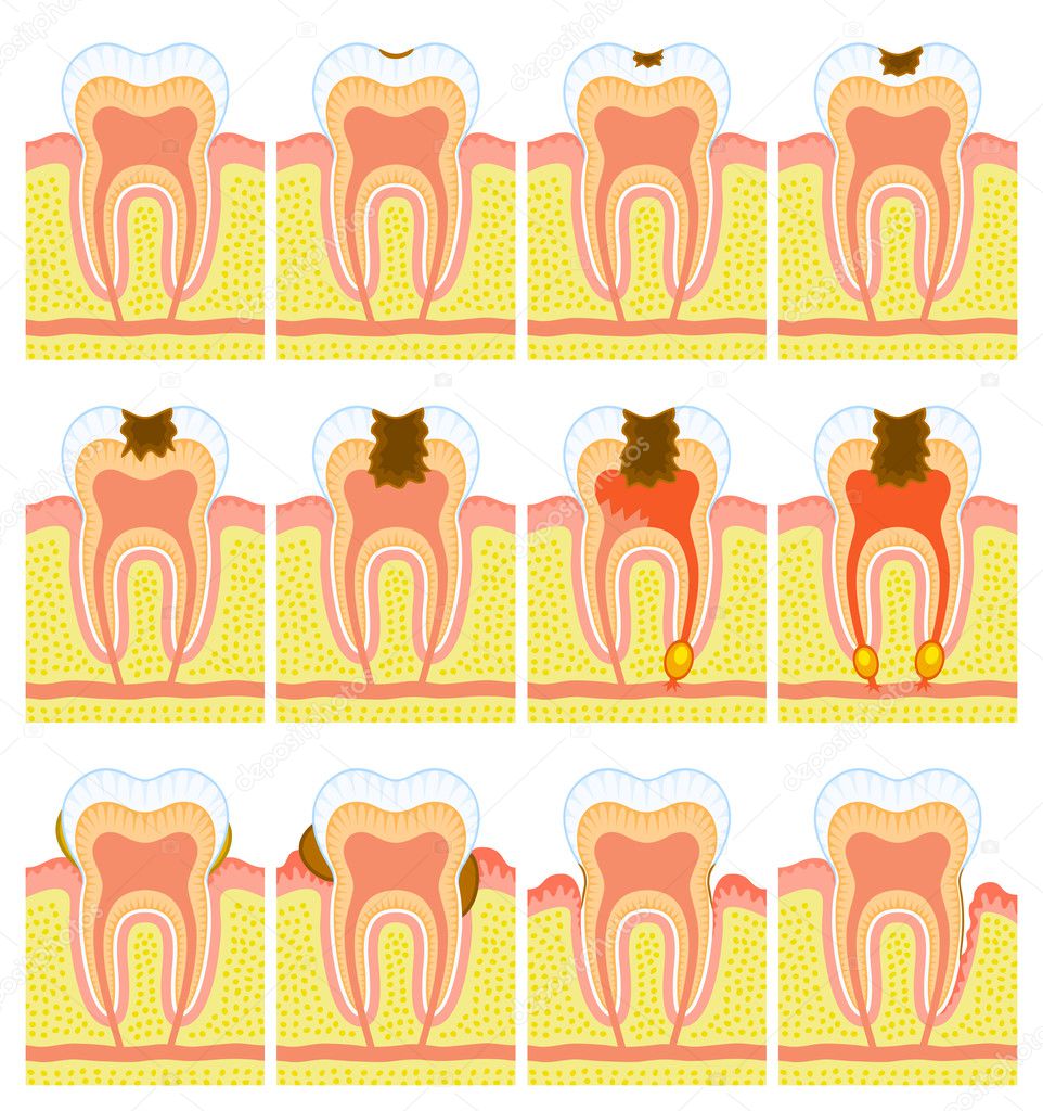 Internal structure of tooth