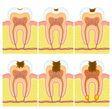 Internal structure of tooth